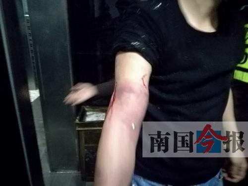 覃先生手臂被卡的部位受傷流血，所幸傷勢無大礙。 通訊員 王建民 攝