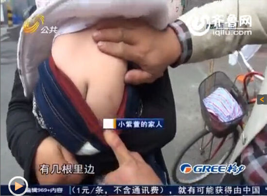 女嬰體內現16根鋼針無法取出 父母懷疑被下黑手