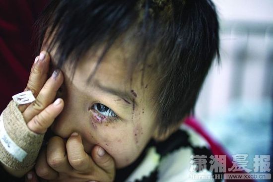 1月13日，湖南省兒童醫院，4歲的源源用手蒙住了眼睛。