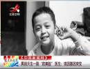 男孩天生一副“歐美臉” 醫生——或因基因突變
