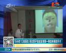 19小時 12名醫生 河北男子完成全球第一例自體換臉手術